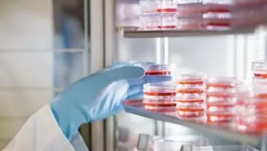 Effective factors of medium on cultured cells