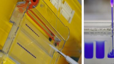 Polyacrylamide Gel Electrophoresis In Western Blot Technique Archives ...