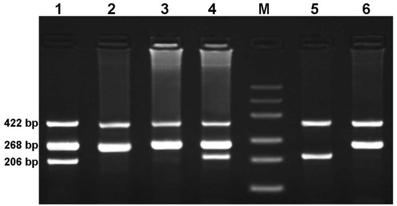 western blot troubleshooting smeared bands