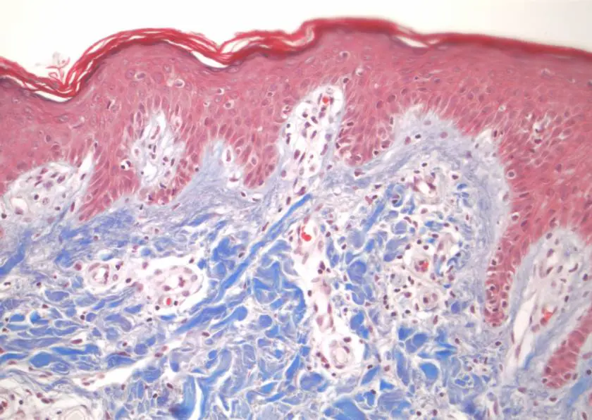 Production of general and specific pathology dyes 
