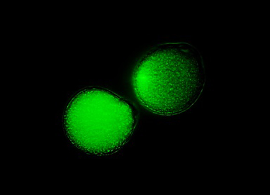 Embryology gametes IVF sperm