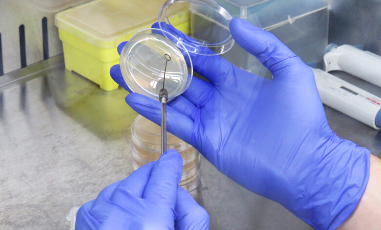 Microbiology services