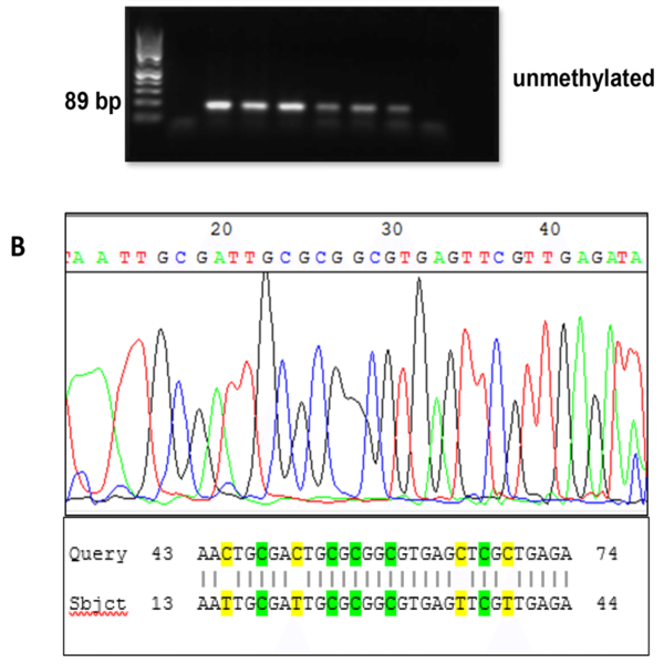 Analysis of BRCA1 promoter methylation status by MS PCR and sanger sequencing A2 1
