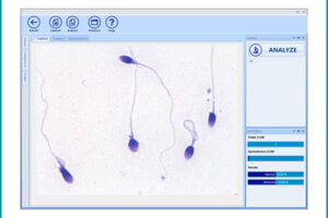 CASA Sperm Analysis mini