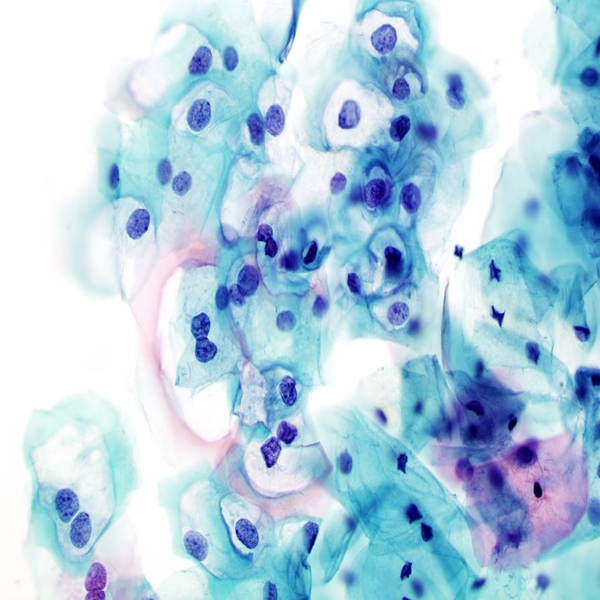 Histological 47 PAP SMEAR