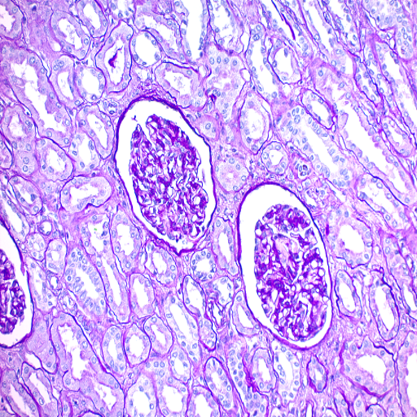 Histological 34 PAS