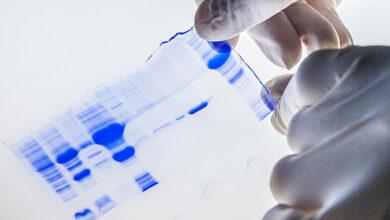 Genetic 25 Protein Gel Stain