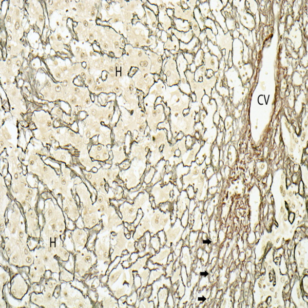 Histological - Histogenotech