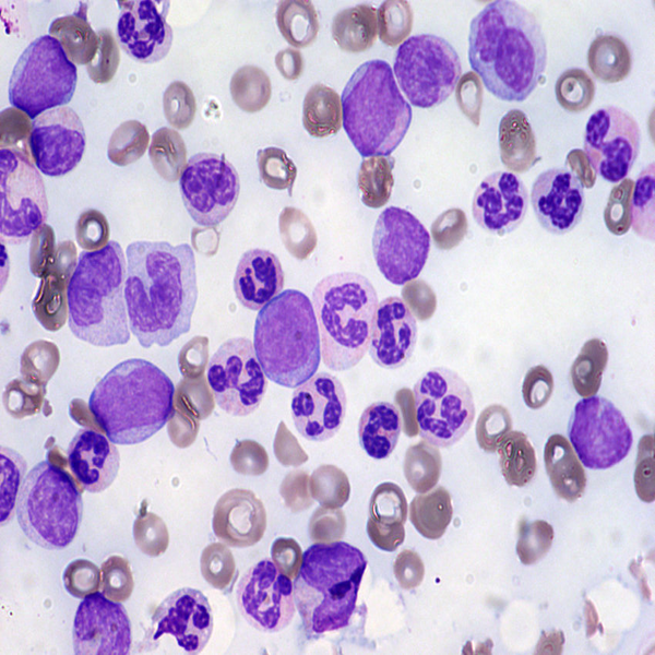 Histological 36 giemsa