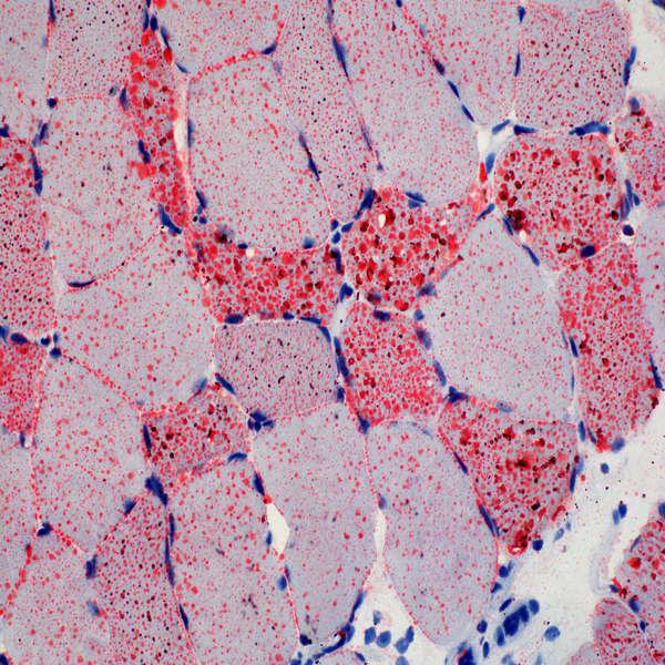 Histological 33 oilredocai02