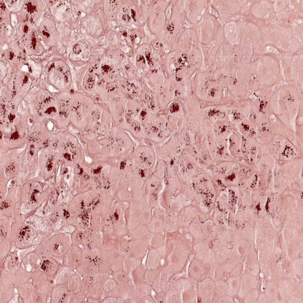 Histological 44 orcein