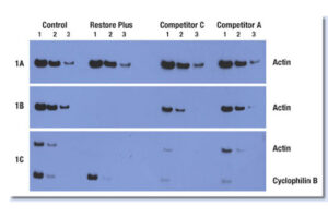 western blot protein bands on X ray film