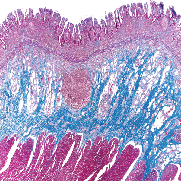 Histological 28 تری کروم