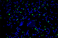سلول های آپوپتوز به رنگ سبز