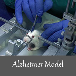 Alzheimer model1
