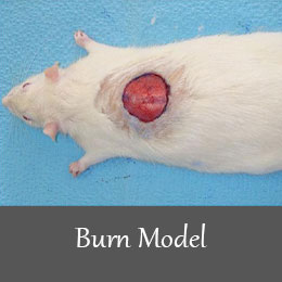 Burn model 1