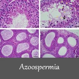 Azoospermia animal model 1