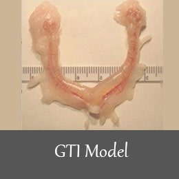 GTI model