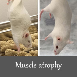 Muscle atrophy