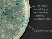 ترانسفورماسیون باکتری E.coli
