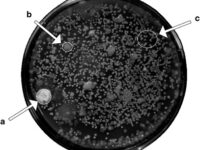جداسازی قارچ های مولد آنتی بیوتیک