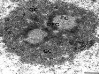 An-electron-micrograph2